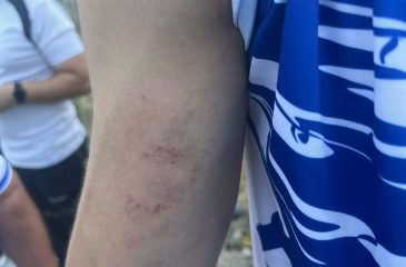 ResendeAgressaoRM1_2026.09.21